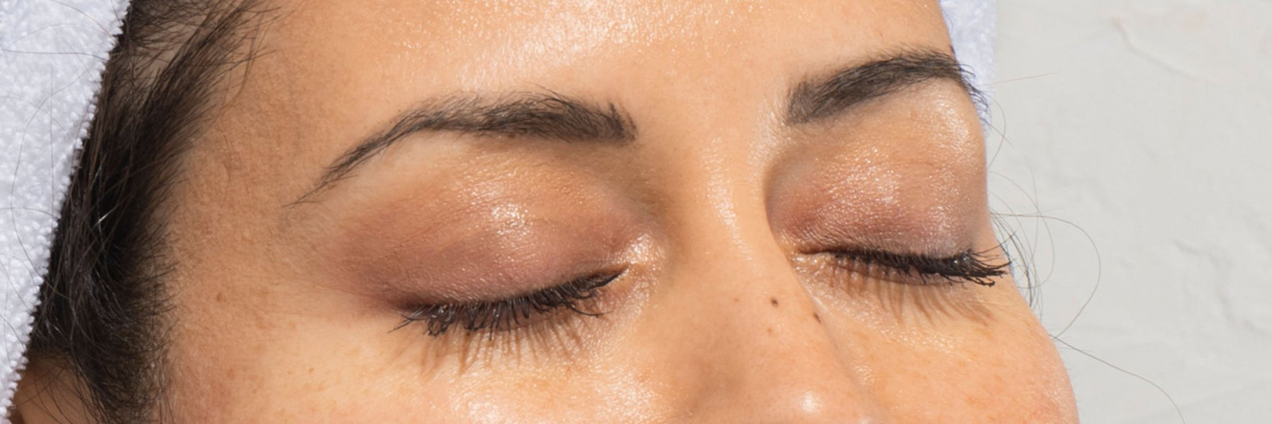 What Causes Dark Circles, Tips to Visibly Reduce