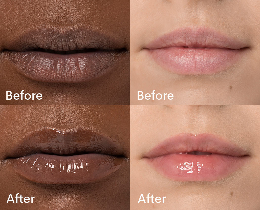before and after pictures for fleur & bee's lip treatment showing dry and hydrated lips