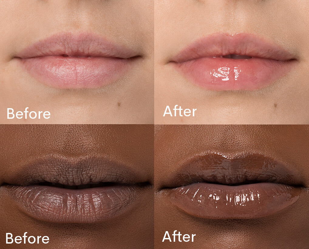 before and after images of lips