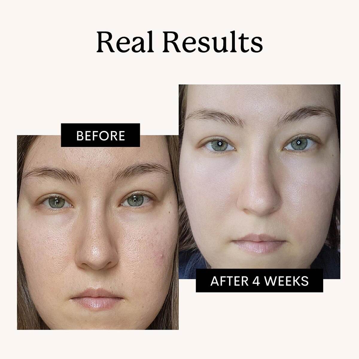 before and after results for retinol moisturizer